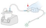Suction Catheter with Control 診所用品 Clinic Supplies