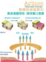 Activon Manuka Honey 醫療級蜂蜜敷料 20g 傷口護理 Wound Care