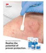 3M Cavilon™ 無痛皮膚保膚膜海棉棒裝 No Sting Barrier Film Foam Applicator (25支/盒) 3M產品